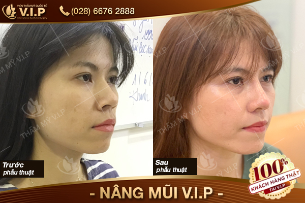 khach-hang--NANG-MUI-VIP-22.jpg