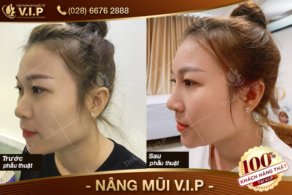 nang-mui-vip-thang-9-8.jpg