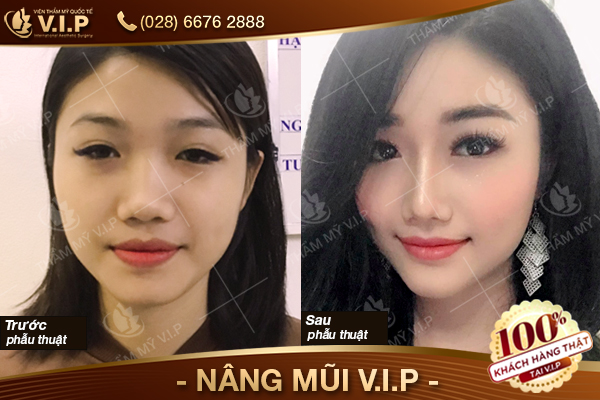 khach-hang--NANG-MUI-VIP-120.jpg