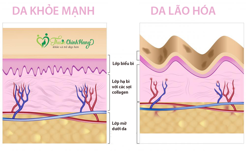 dau-hieu-cua-lao-hoa-da-som.jpg