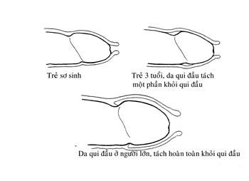 cac-dang-hep-bao-quy-dau.jpg