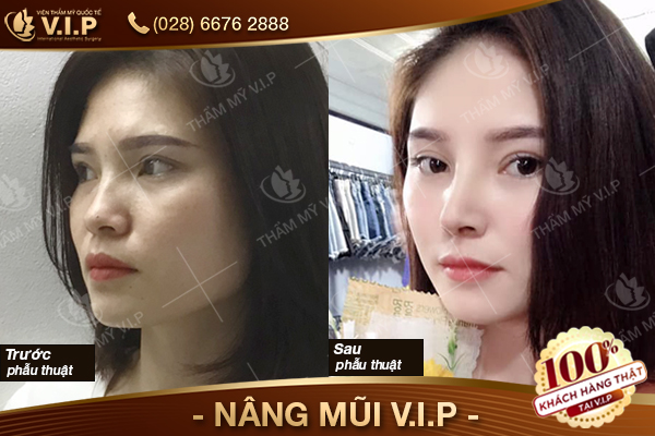 khach-hang--NANG-MUI-VIP-116.jpg