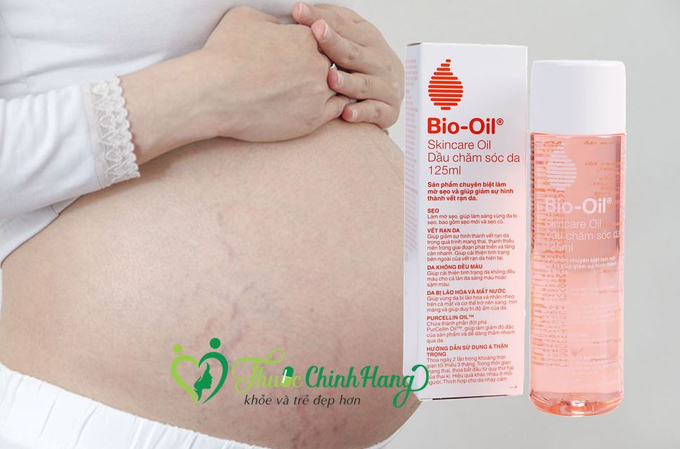kem-tri-ran-da-bio-oil-125-ml-gia-bao-nhieu.jpg