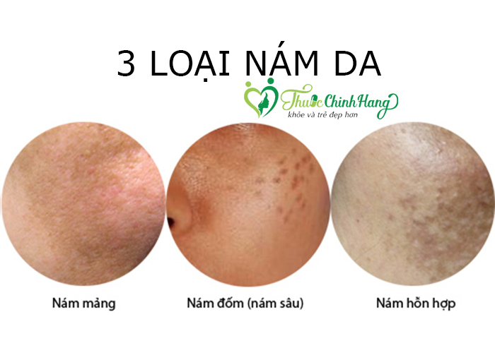 Da-bi-nam-nen-dung-sua-rua-mat-gi-tot.jpg