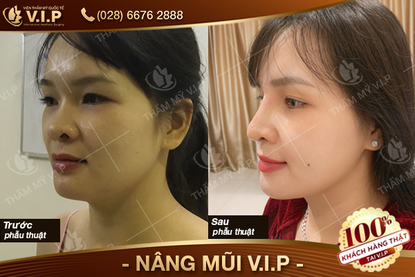 nang-mui-vip-thang-9-7.jpg