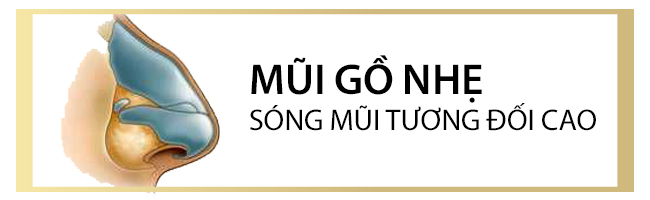 got-mui-go-2.jpg