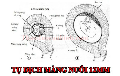 m%25E1%25BB%2599t%2Btr%25C6%25B0%25E1%25BB%259Dng%2Bh%25E1%25BB%25A3p%2Bc%25E1%25BB%25A7a%2Bt%25E1%25BB%25A5%2Bd%25E1%25BB%258Bch%2Bm%25C3%25A0ng%2Bnu%25C3%25B4i.jpg
